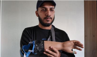 Wounded Bangladesh protesters receive robotic helping hand