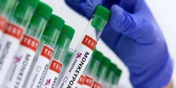 Mpox update: 25 confirmed cases, 9 deaths reported in Sindh