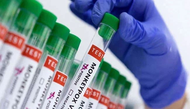 Mpox update: 25 confirmed cases, 9 deaths reported in Sindh