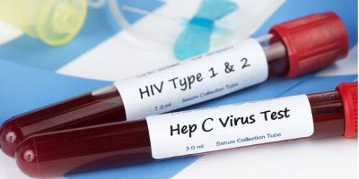 Govt makes HIV, Hepatitis B & C screening mandatory