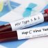 Govt makes HIV, Hepatitis B & C screening mandatory