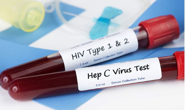 Govt makes HIV, Hepatitis B & C screening mandatory